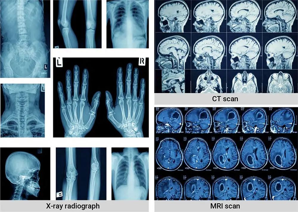 移动式医用X射线机 1.jpg